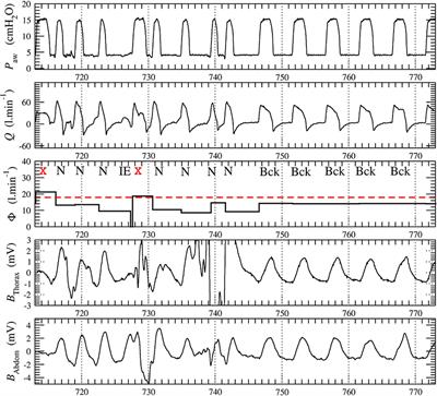 Patient-Ventilator Synchronization During Non-invasive Ventilation: A Pilot Study of an Automated Analysis System